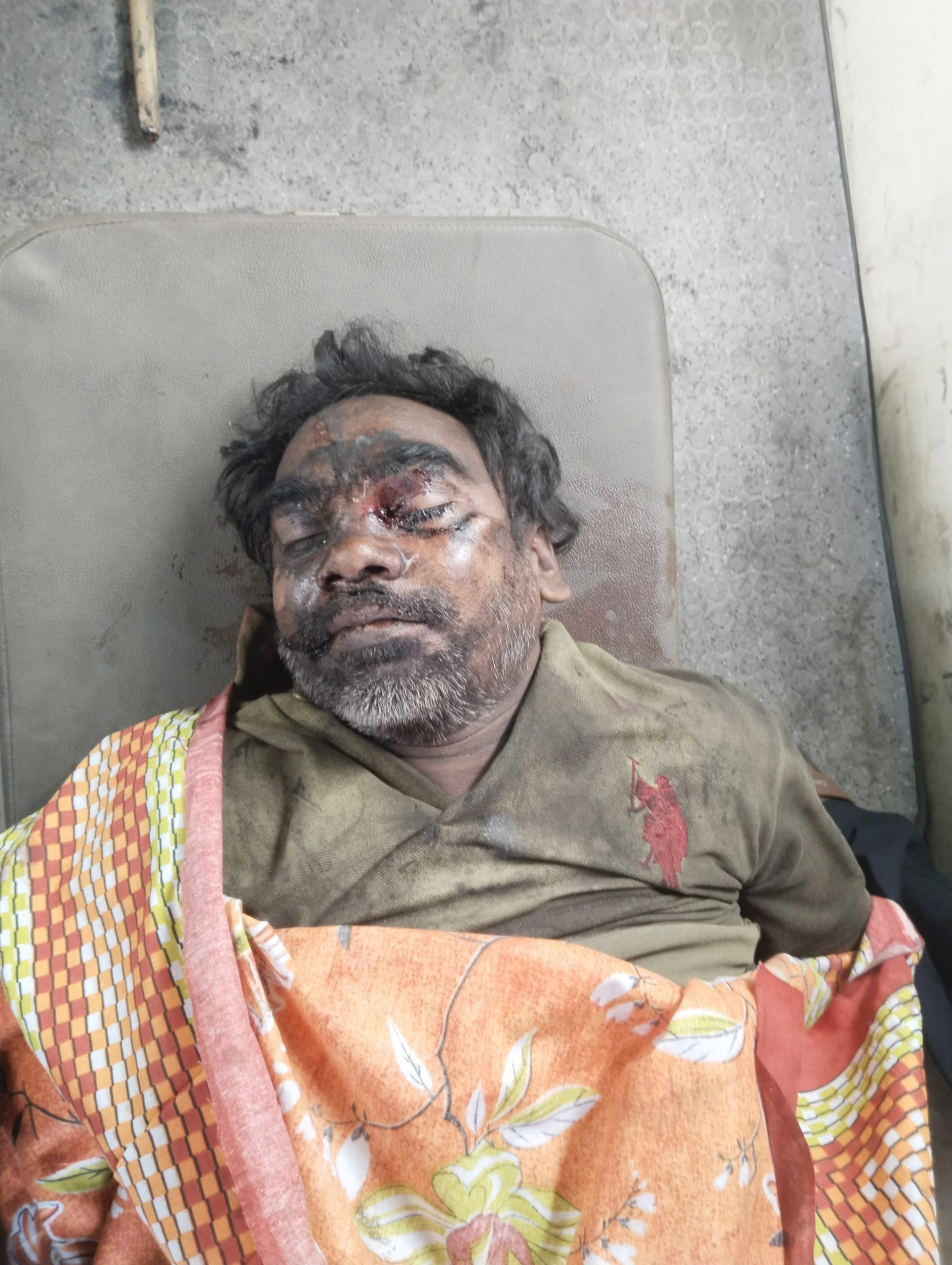 सीसीएल कर्मी की दर्दनाक मौत